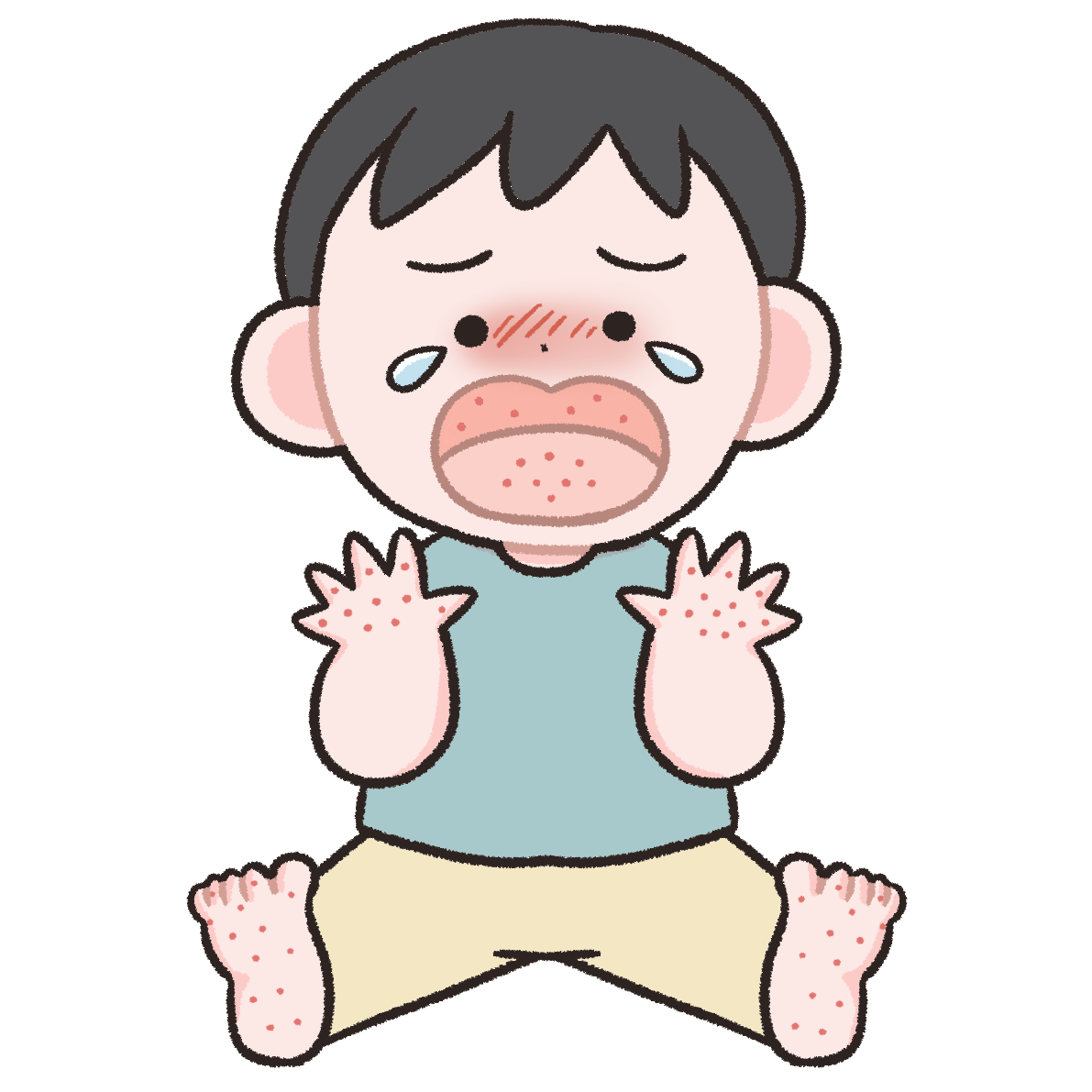 【フリー素材】手足口病